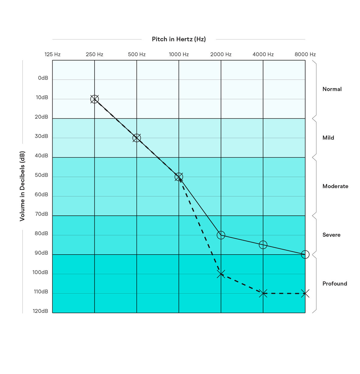Understanding Your Audiogram | Apps & Resources • NextSense